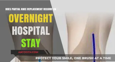 Partial Knee Replacement: Overnight Hospital Stay Necessary or Not?
