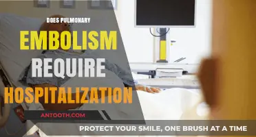 Pulmonary Embolism: When Hospitalization Becomes a Necessary Treatment Option