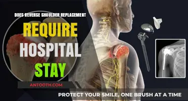 Reverse Shoulder Replacement: Hospital Stay Needed?