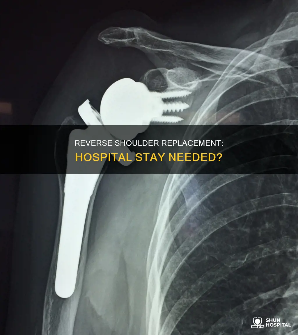 does reverse shoulder replacement require hospital stay