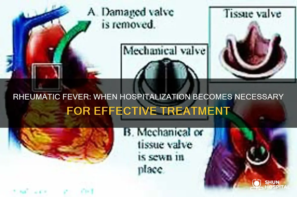 does rheumatic fever require hospitalization