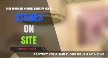 Does Southeast Hospital Offer On-Site Kidney Stone Breakup Services?