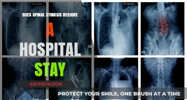Spinal Stenosis: Hospital Stay or Outpatient Treatment?