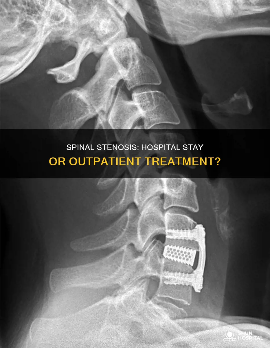 does spinal stinosis require a hospital stay