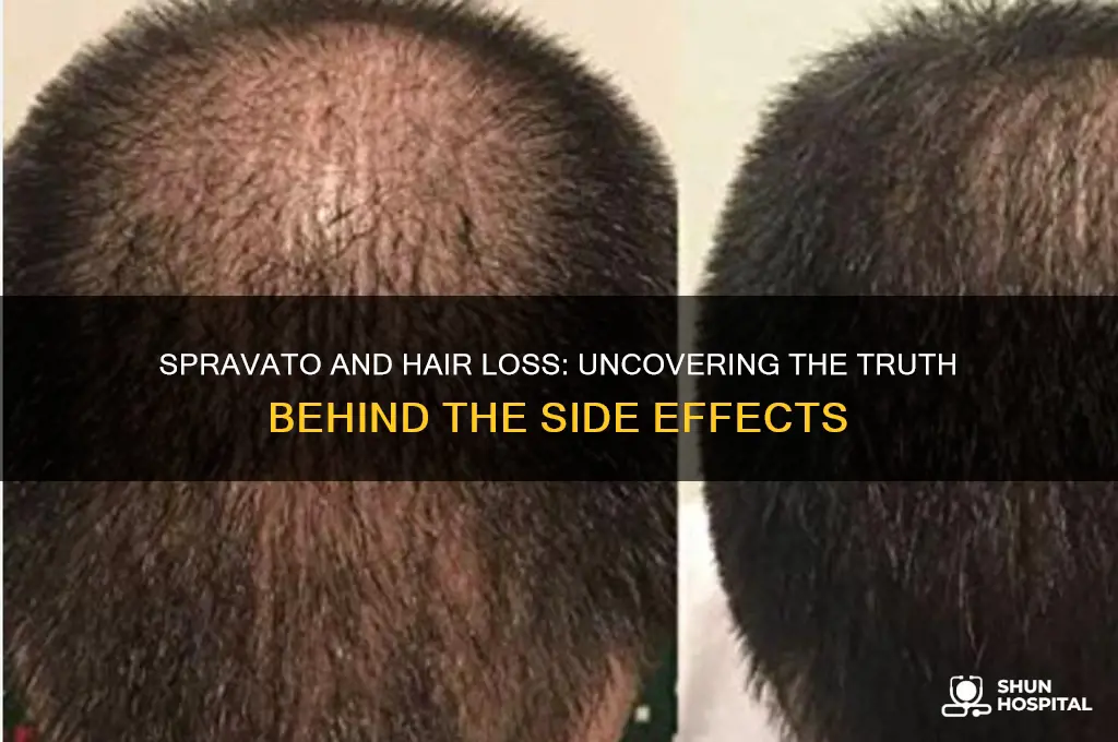 does spravato cause hair loss