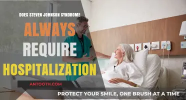 Hospitalization: When is it Necessary for Steven Johnson Syndrome?
