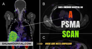 Swedish Hospital: Offering Advanced PSMA Scans