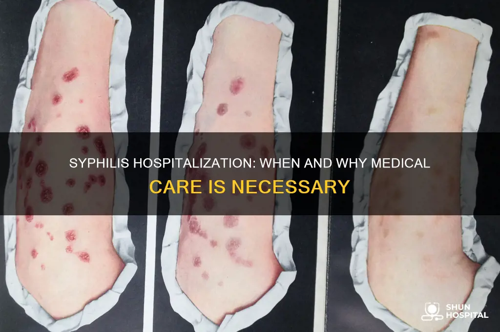 does syphilis require hospitalization
