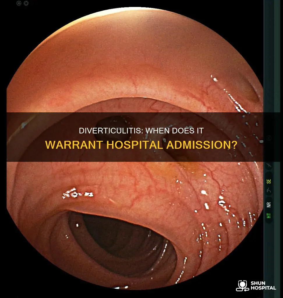 does the hospital admit you for diverticulitis