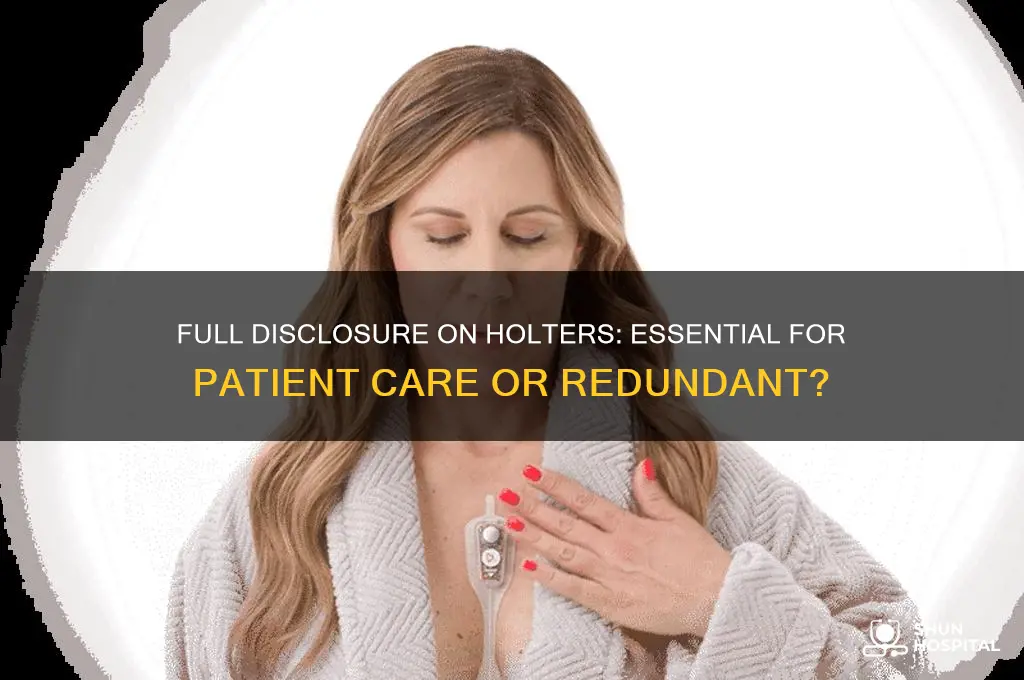 does the hospital need to save full disclosure on holters