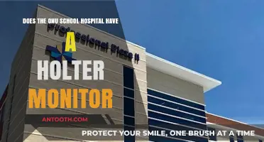 Does ONU School Hospital Offer Holter Monitor Services? Find Out