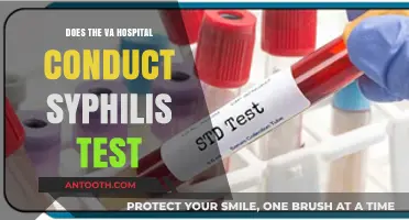 Syphilis Testing: VA Hospital's Role