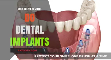 VA Hospital: Dental Implants Available?