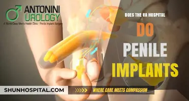 VA Hospitals: Penile Implants Available?