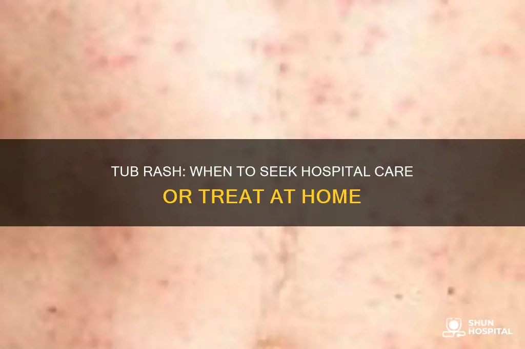 does tub rash require hospitalization