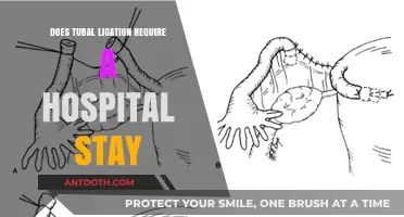 Tubal Ligation: Hospital Stay or Outpatient Procedure?