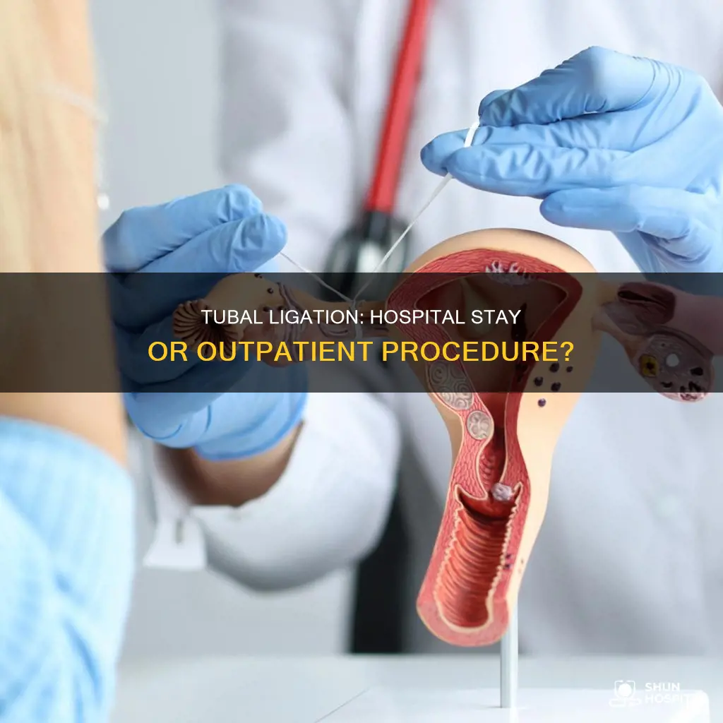 does tubal ligation require a hospital stay