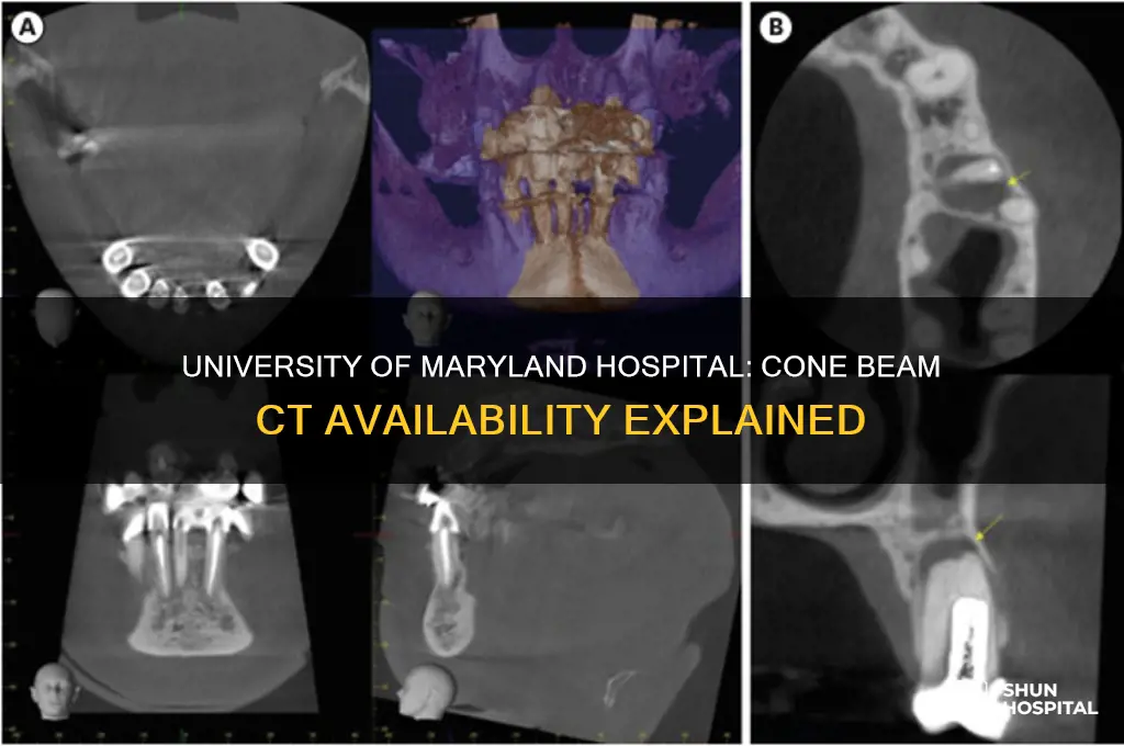 does university of md hospital have a cone ct