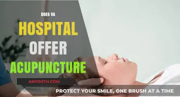 Does VA Hospital Offer Acupuncture? Exploring Alternative Therapies for Veterans