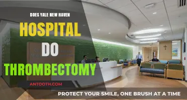 Thrombectomy at Yale New Haven Hospital: What You Need to Know