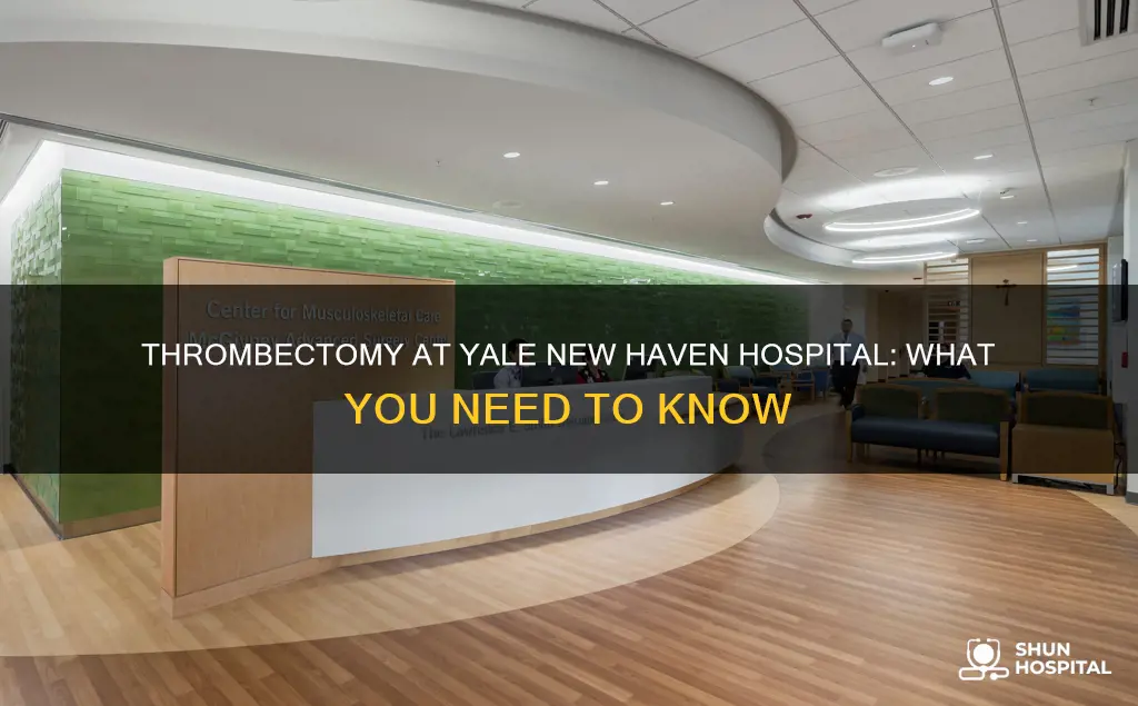 does yale new haven hospital do thrombectomy
