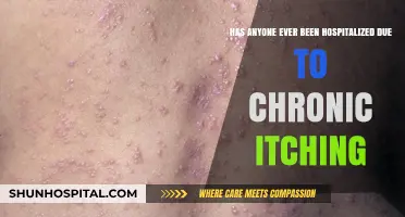 Chronic Itching Hospitalization: Real Cases and Medical Insights Revealed