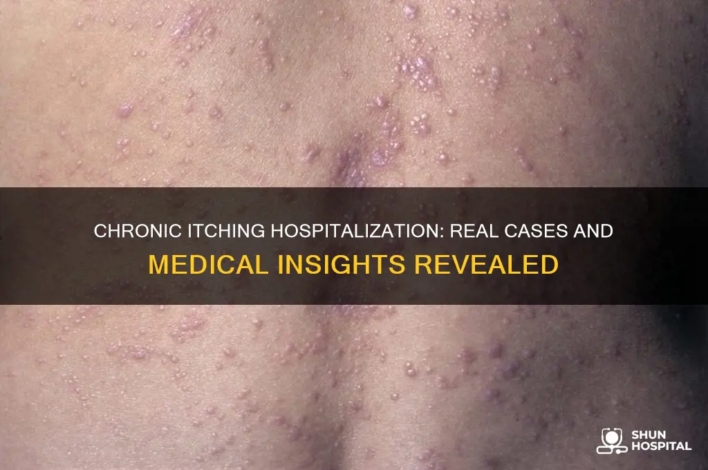 has anyone ever been hospitalized due to chronic itching