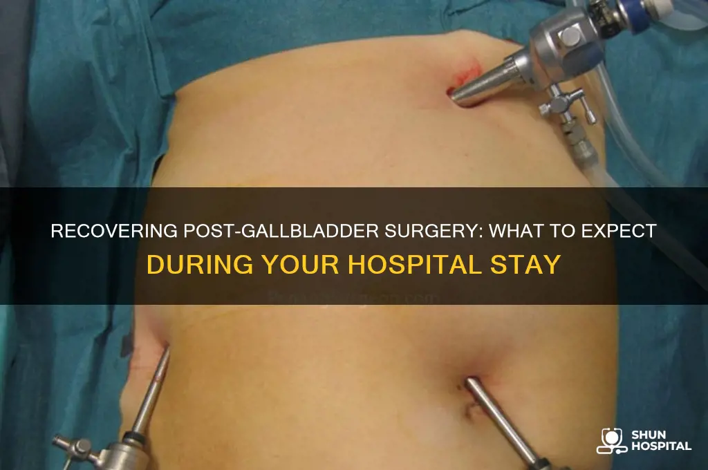 have to stay in the hospital after gallbladder surgery