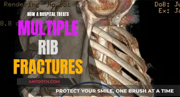 Hospital Treatment for Multiple Rib Fractures