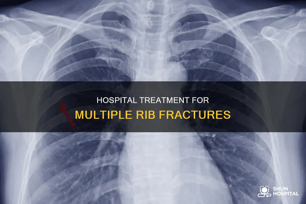 how a hospital treats multiple rib fractures