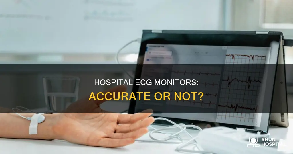 how accurate is a hospital ecg monitor