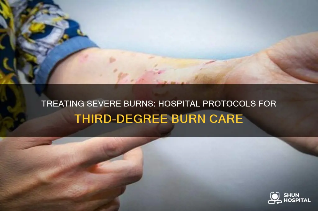 how are 3rd degree burns treated in the hospital