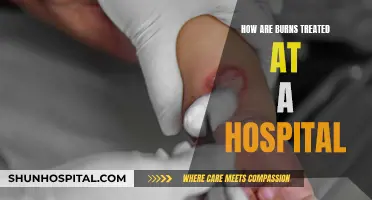 Burns: Hospital Treatment and Care Options