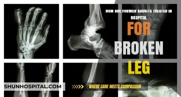 Compassionate Care: Treating Former Addicts with Broken Legs in Hospitals