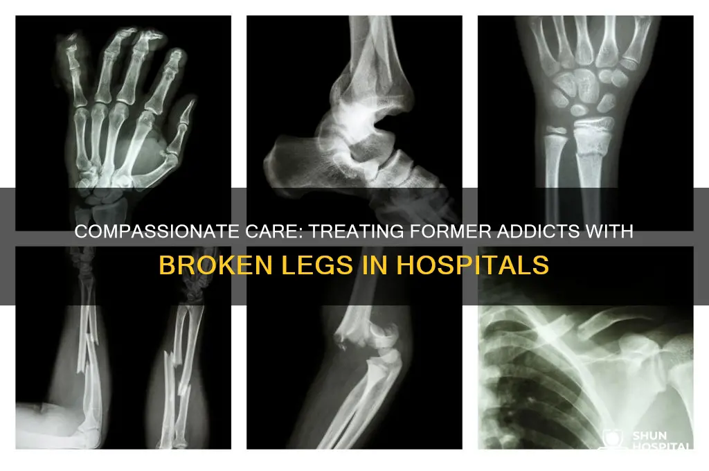 how are former addicts treated in hospital for broken leg