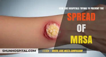 Combating MRSA: Innovative Hospital Strategies to Prevent Superbug Spread