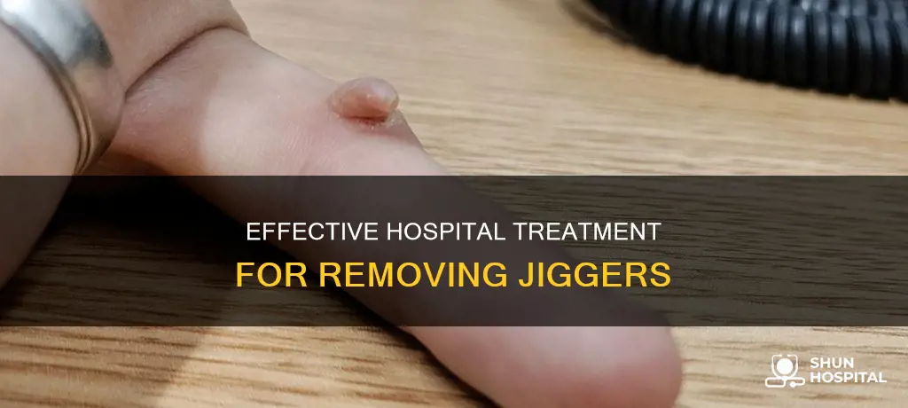 how are jiggers removed in a hospital