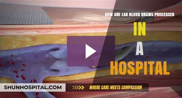 Understanding the Hospital Lab Blood Draw Processing Procedure
