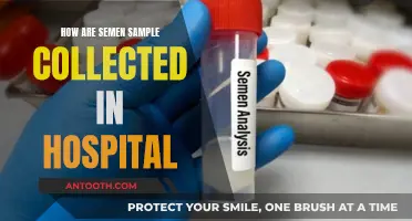 Semen Sample Collection: Hospital Procedures Explained