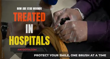 Treating Stab Wounds: Hospital Procedures and Techniques
