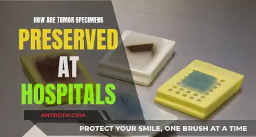 Tumor Specimen Preservation: Techniques and Hospital Protocols