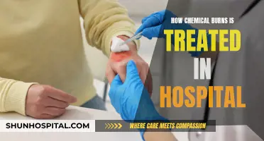 Chemical Burns: Hospital Treatment and Care