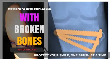 Healing Fractures: Ancient Remedies for Broken Bones Before Modern Hospitals