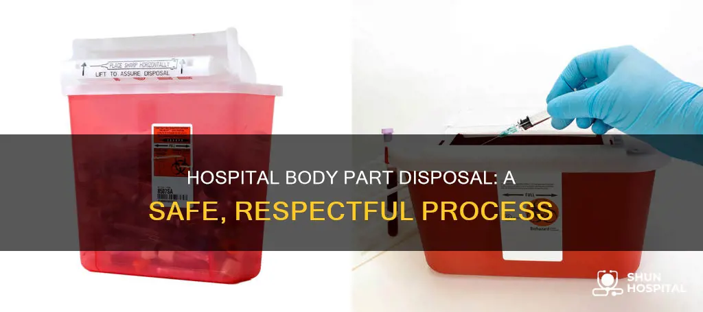 how do hospital dispose of body parts
