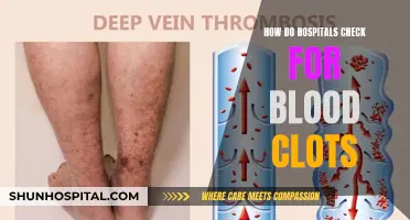 Detecting Blood Clots: Hospital Techniques and Procedures