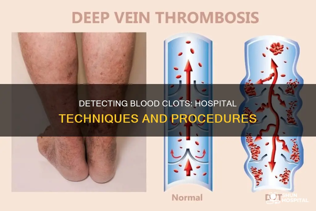 how do hospitals check for blood clots