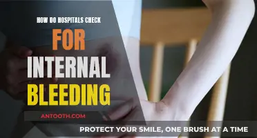 Internal Bleeding: Hospital Detection Techniques and Procedures
