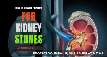 Detecting Kidney Stones: Hospital Diagnostics and Imaging Techniques