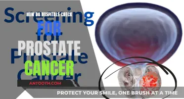 Prostate Cancer Checks: What Hospitals Do and Why