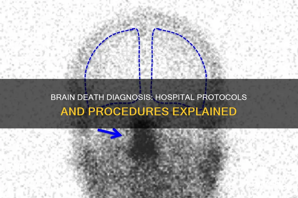 how do hospitals check if someone is brain dead